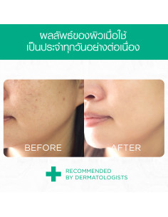 Smooth E Face Lift External Capsules 2