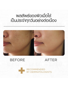 Smooth E Gold 12 Capsules 2