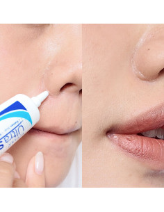 Vitara Ultra Silicone Scar 9g - 1 2